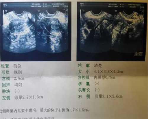 合肥有代孕过有宝宝的吗,北京供卵试管中